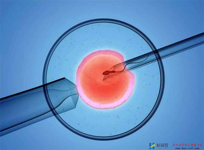 做试管婴儿一般要多少钱?(图1) 做试管婴儿一般要多少钱?(图1)