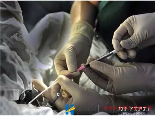 30岁产妇做试管婴儿全过程,看完心疼女人一万遍!(图7) 30岁产妇做试管婴儿全过程,看完心疼女人一万遍!(图7)
