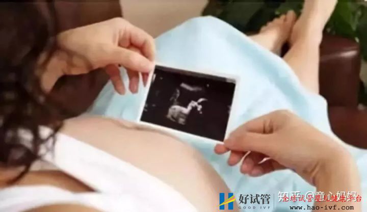 过了30岁做试管婴儿,关注这些比关注成功率更重要!(图9) 过了30岁做试管婴儿,关注这些比关注成功率更重要!(图9)