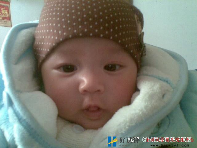 46岁借卵生子成功率高吗高龄供卵试管婴儿案例分享(图3) 46岁借卵生子成功率高吗高龄供卵试管婴儿案例分享(图3)