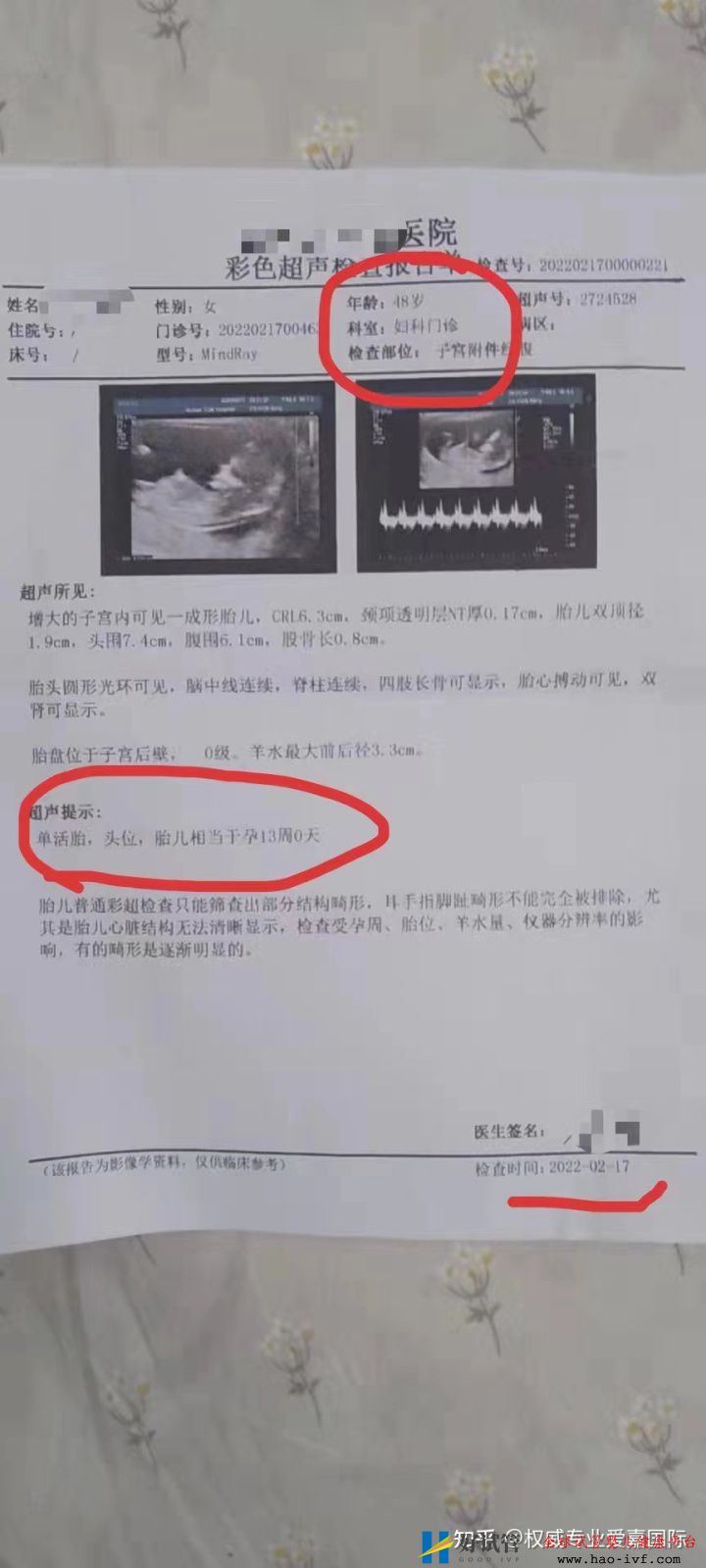 48岁做试管婴儿第三代成功率多少(图1) 48岁做试管婴儿第三代成功率多少(图1)