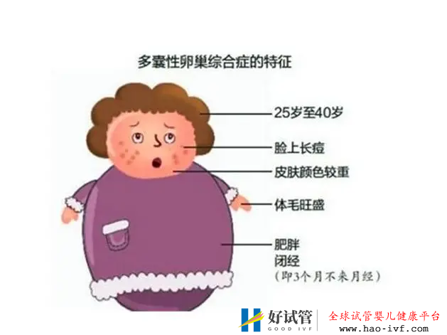 多囊患者可以做试管婴儿吗?试管成功率大吗?(图3) 多囊患者可以做试管婴儿吗?试管成功率大吗?(图3)