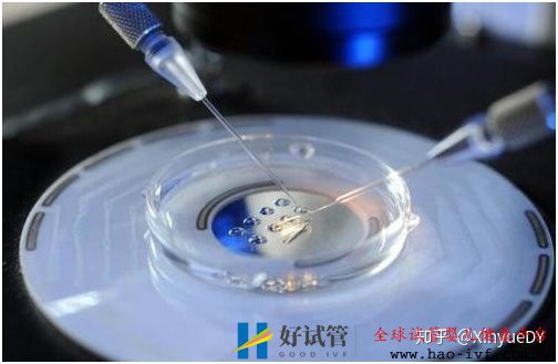 详解第一代、第二代、第三代试管婴儿以及适应症,...(图3) 详解第一代、第二代、第三代试管婴儿以及适应症,...(图3)