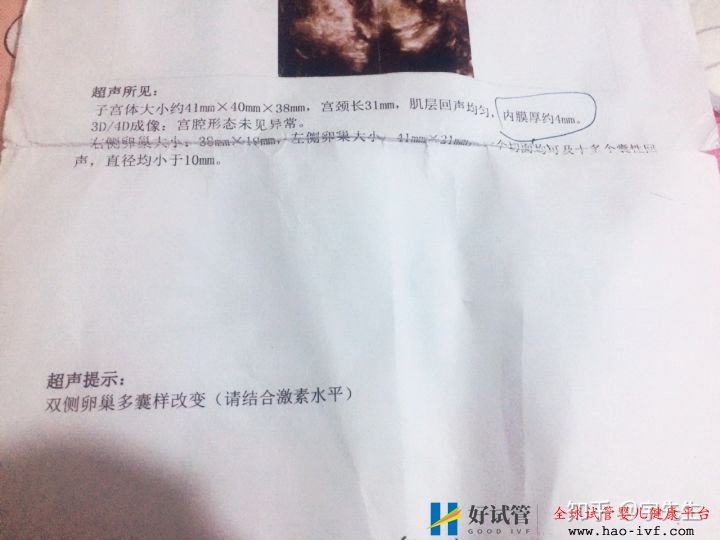 接好孕,多囊卵巢综合症的我,做试管不生双胞胎后悔了(图4) 接好孕,多囊卵巢综合症的我,做试管不生双胞胎后悔了(图4)