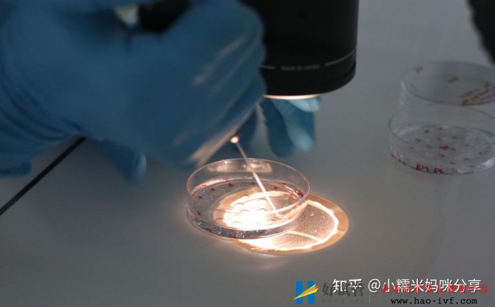 多囊姐妹做三代试管技术有多高成功率(图1) 多囊姐妹做三代试管技术有多高成功率(图1)