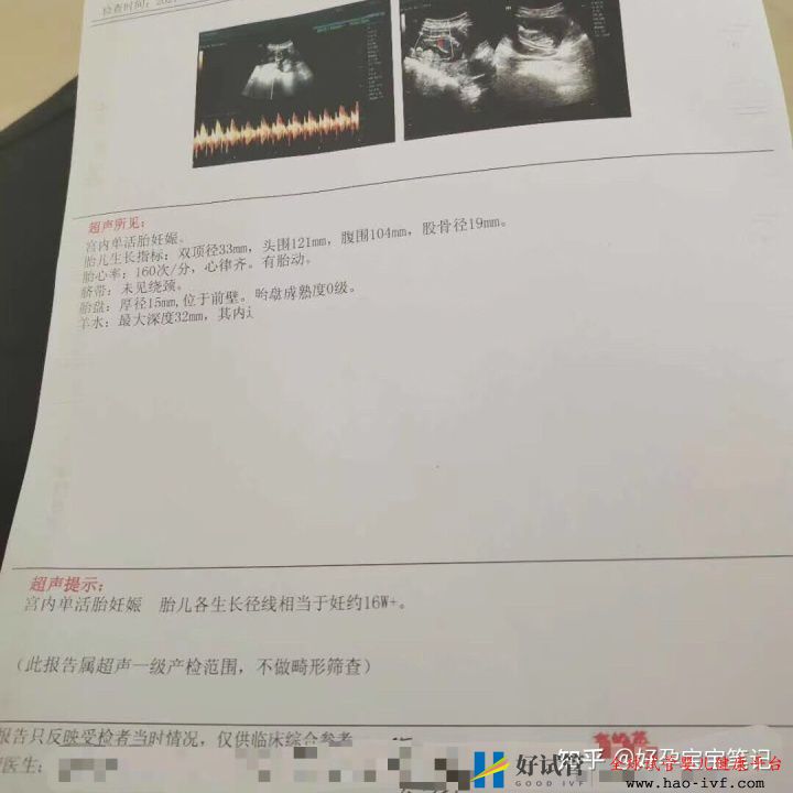 多囊多年至不孕,试管移植二次成功!经验分享!(图5) 多囊多年至不孕,试管移植二次成功!经验分享!(图5)