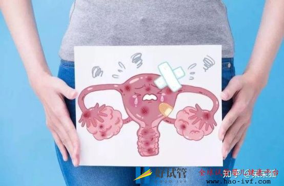 卵巢早衰做试管成功率高不高(图1) 卵巢早衰做试管成功率高不高(图1)