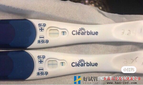 32岁卵巢早衰,通过试管移植一次成功怀孕经验分享(图5) 32岁卵巢早衰,通过试管移植一次成功怀孕经验分享(图5)