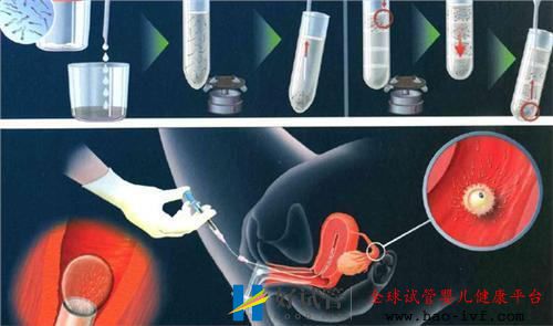 做试管期间可以喝蜂蜜水吗移植后不能喝蜂蜜水吗(图1) 做试管期间可以喝蜂蜜水吗移植后不能喝蜂蜜水吗(图1)