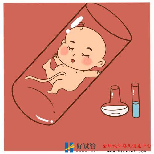 现在很多宝妈做试管婴儿,试管婴儿要注意什么呢?(图1) 现在很多宝妈做试管婴儿,试管婴儿要注意什么呢?(图1)