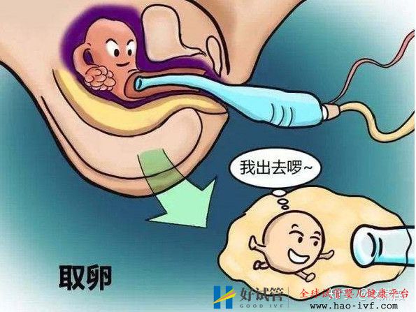 试管婴儿全流程介绍(图5) 试管婴儿全流程介绍(图5)