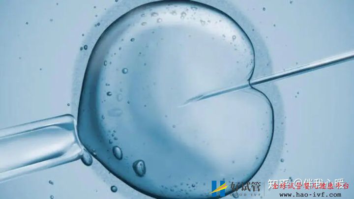 试管婴儿需要花多少时间试管全流程大公开建议收藏!(图5) 试管婴儿需要花多少时间试管全流程大公开建议收藏!(图5)