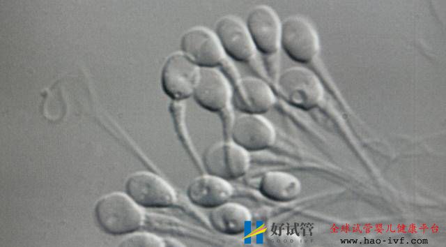 备孕小夫妻:试管婴儿和普通婴儿有什么不一样吗?(图1) 备孕小夫妻:试管婴儿和普通婴儿有什么不一样吗?(图1)