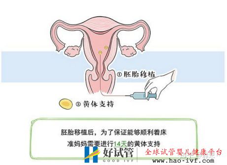 女人做试管过程痛苦吗(图5) 女人做试管过程痛苦吗(图5)