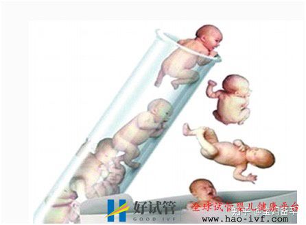 符合这三个条件中的其中一个,就可以做试管婴儿了(图1) 符合这三个条件中的其中一个,就可以做试管婴儿了(图1)