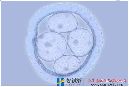 移植鲜胚是有条件的,试管须知事项!(图1) 移植鲜胚是有条件的,试管须知事项!(图1)