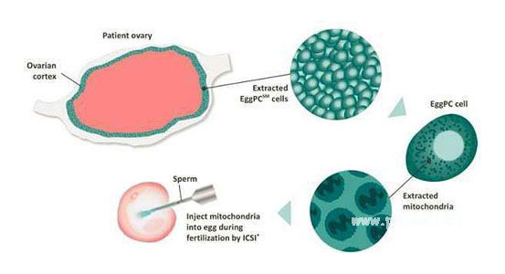 第四代试管婴儿(GVT)费用_流程_成功率介绍(图2) 2.jpg