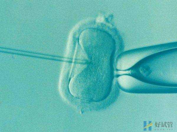 石家庄市第四医院(石家庄妇产医院)(图3) 石家庄妇产医院试管费用