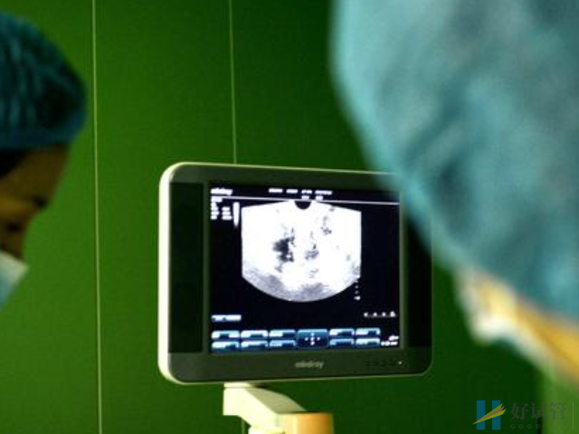 试管促排提早排了是有原因的,这些排卵征兆必须要清楚(图1) 试管促排卵会提前早排