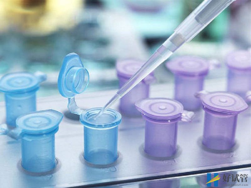 美国助孕费用贵不贵?仅试管就有5个流程的费用(图2) 美国衣食住行费用