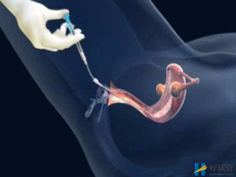 促黄体生成素正常值是多少?看专家是怎么说的(图1) 促黄体生成素的正常值