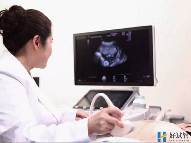 NT检查一次性通过有技巧,避免这些查不出的坑(图1) Nt检查