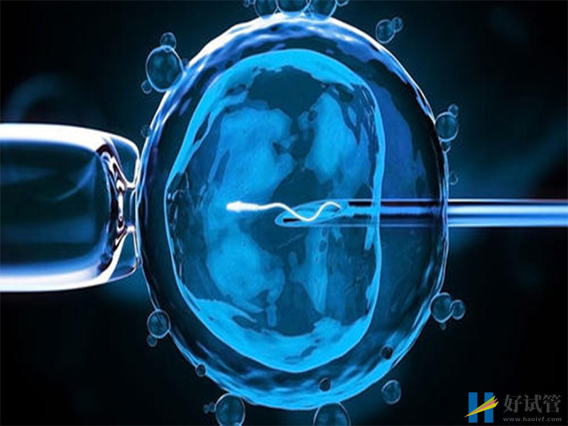 俄罗斯试管婴儿短方案过程不复杂,这5个环节最重要(图1) 俄罗斯试管短方案流程