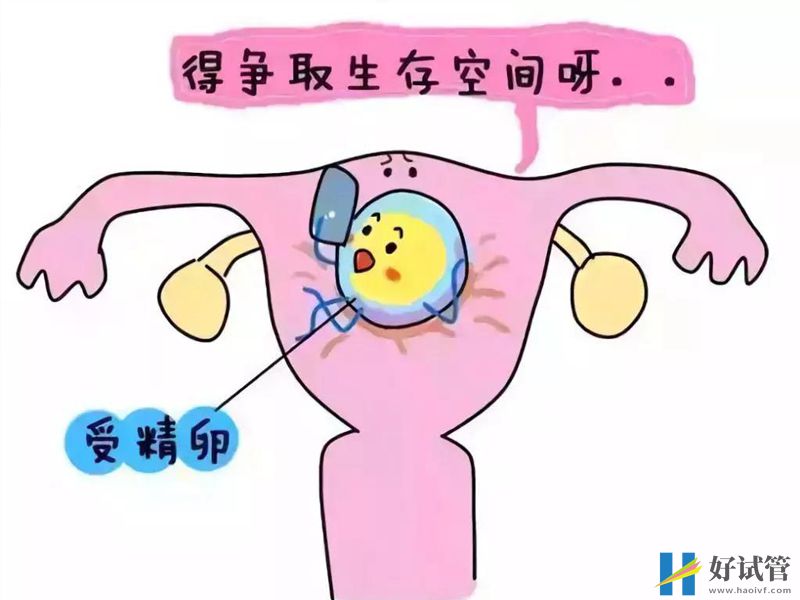 宫腔粘连患者做试管别着急,这五项预防措施一定要先做(图1) 刮宫可引起宫腔粘连