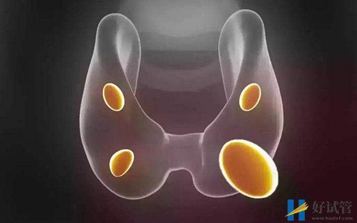 卵泡不破的原因已找到,卵泡闭锁、内分泌失调是主因(图1) 内分泌紊乱会导致卵泡不破裂