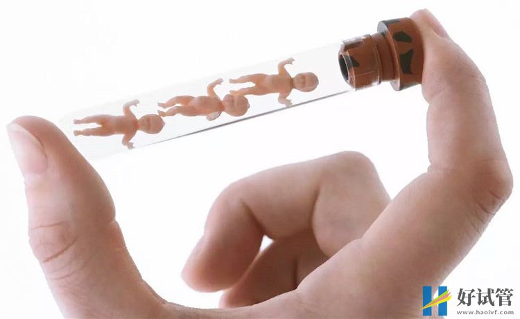 久治不愈的死精症生育难,试管婴儿或是最后方法(图1) 试管婴儿为死精症患者带来生育希望