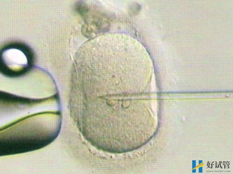 冻胚移植第十天除了hcg数值有变化还有什么反应?(图1) 冻胚移植十天会有少量阴道出血