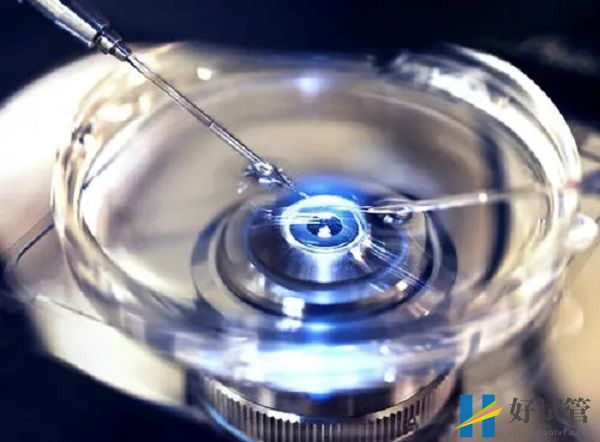 深圳生殖医院试管婴儿费用清单,一代、二代花销都不同(图2) 深圳罗湖医院开展有试管婴儿技术