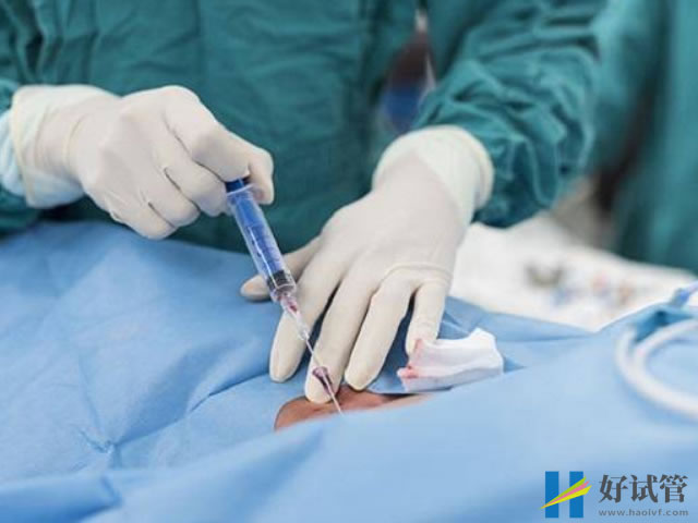 南阳试管婴儿价格表一览,中心医院和一院收费差异不大(图2) 取卵分为局麻和全麻