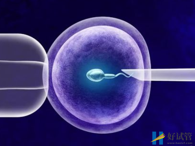 做试管单次成功率达100%不是梦,请提前做好这些准备(图1) 试管成功率因人而异