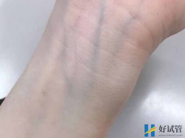 看孕妇手腕真能看出胎儿性别,过来人手把手教你测男女(图1) 手腕测生男生女方法