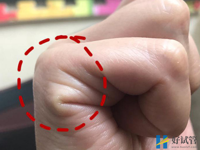 孕妇右手握拳看男女有玄机,后代线已暗示准二胎性别(图3) 婚姻线可以看生男生女