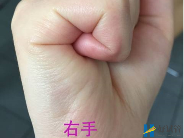 孕妇右手握拳看男女有玄机,后代线已暗示准二胎性别(图4) 右手握拳看男女不准