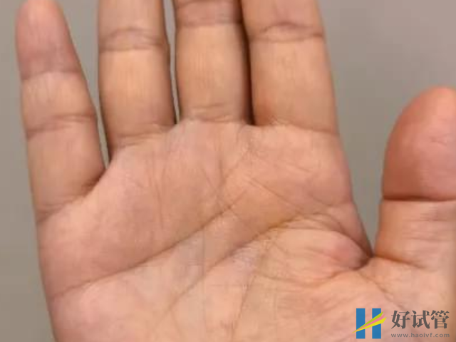 孕妇子女线看生男生女顺序图解,左手右手都能看(图2) 子女线能看出生几胎