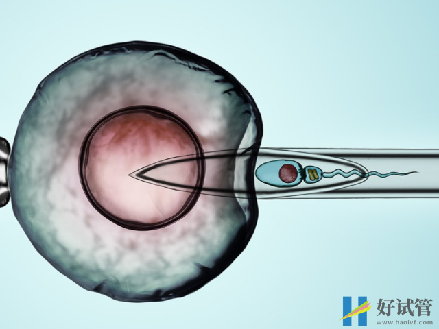 正规三代供卵试管成功案例分享,附我手术全过程及费用明细(图1) 供卵试管采用的是第三方卵子