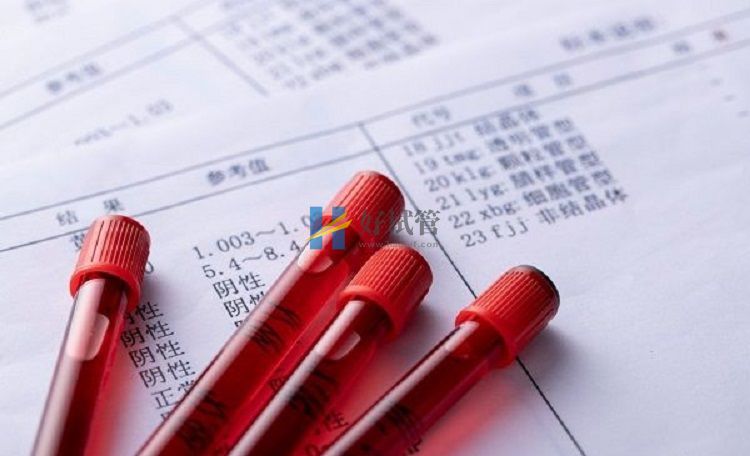 卵巢功能衰退妊娠率低难有孕期,供卵试管婴儿或成唯一办法(图1) FSH值可判断卵巢功能