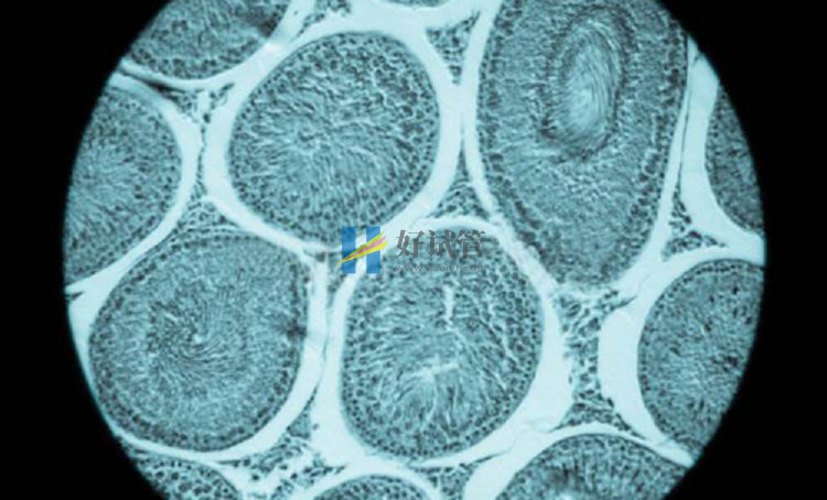 卵巢功能衰退妊娠率低难有孕期,供卵试管婴儿或成唯一办法(图2) 卵巢功能衰退影响怀孕