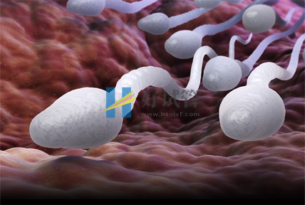 精子头部异常是什么原因造成的(图1) 精子头部异常是什么原因造成的(图1)