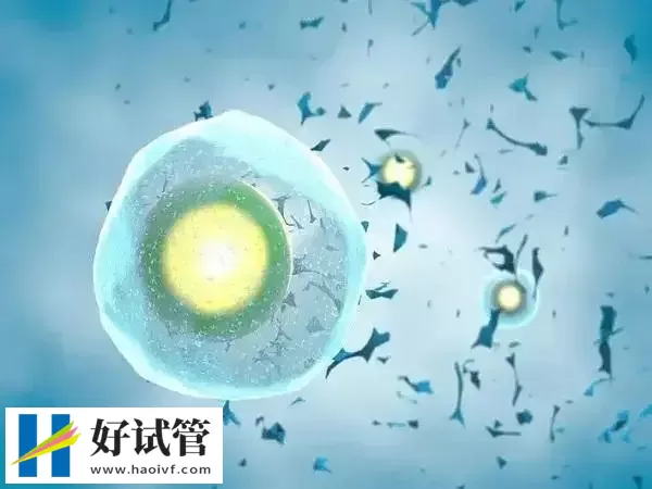 试管婴儿移植后为什么会有宫腔积液(图1) 移植后要注意局部的清洁护理以免感染