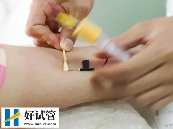 黔南试管婴儿解冻移植前需做哪些检查(图1) 移植前做抽血检查是必须的