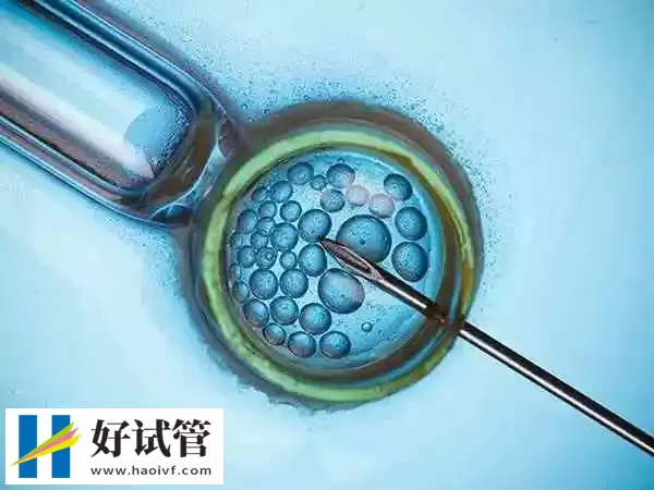 黔西南试管婴儿哪个促排卵方案成功率高(图1) 每个患者促排卵的方案都不一样