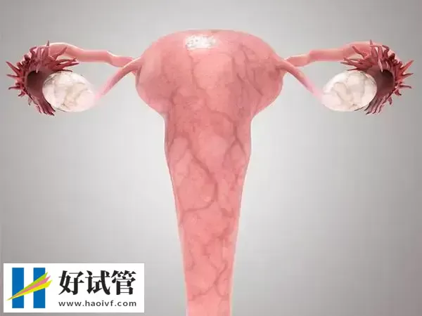 巴中试管婴儿移植后子宫血流不好怎么改善(图1) 子宫血流不好会影响试管成功率