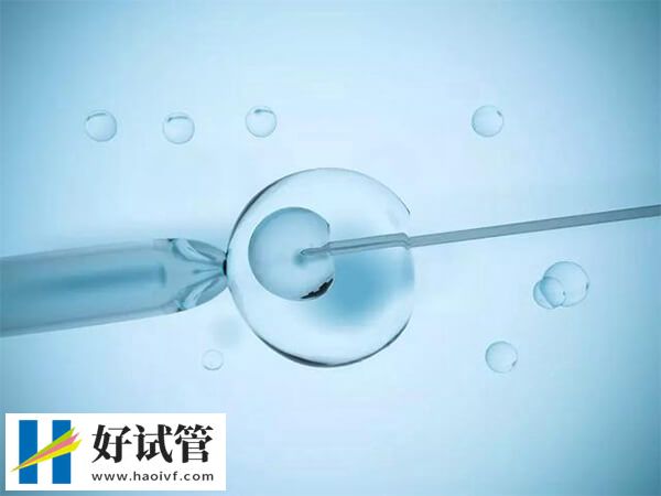 巴中双腔取卵的优势有哪些(图1) 双腔取卵能获得更多卵子