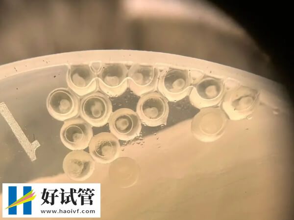 揭秘株洲妇幼是否有卵子库,附供卵试管婴儿价格明细(图1) 株洲妇幼没有现卵