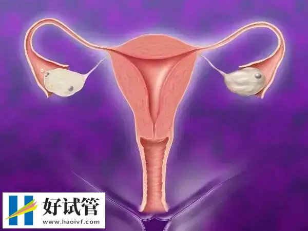 凉山卵巢早衰如何怀孕生孩子(图1) 卵巢功能早衰的女性存在怀孕困难的风险