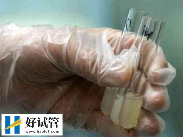 白细胞精子症会不会影响生育(图1) 白细胞精子症会影响精子功能